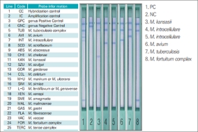 PCR → Line Probe Assay (LPA)방법