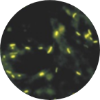 집균도말, 형광염색법(Auramine O) 현미경으로 본 모습