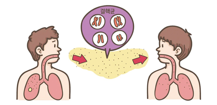 결핵균이 결핵확자의 기침을 통해 3자의 호흡을 통해 감염되는 모습의 그림